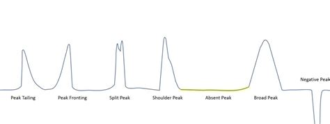 peak shape problems in hplc.